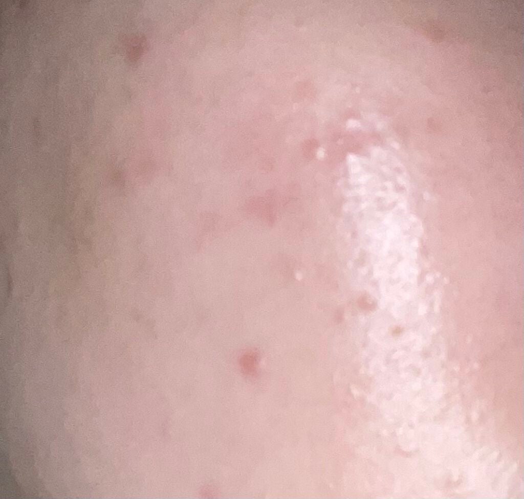 潤浸保湿 化粧水 III とてもしっとり/キュレル/化粧水を使ったクチコミ(2枚目)