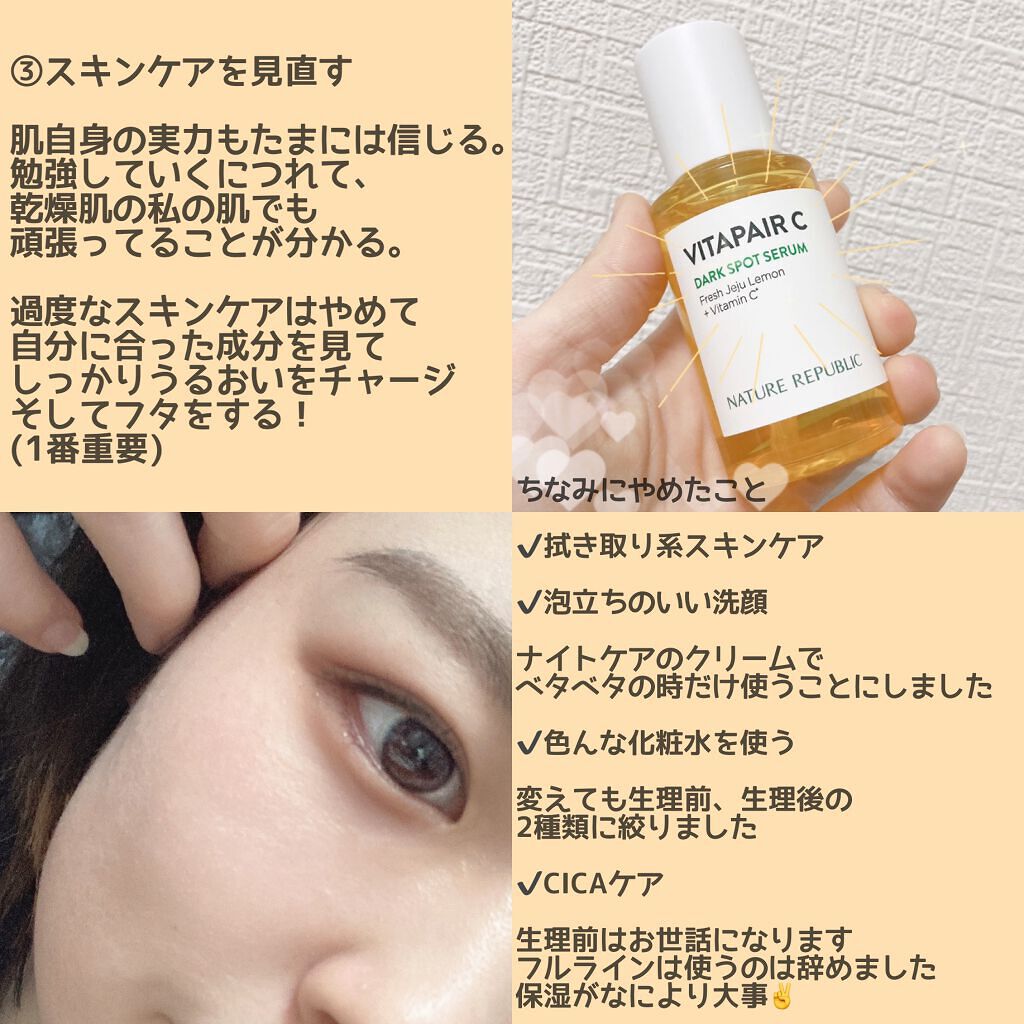 ビタペアC 集中美容液スペシャルセット/ネイチャーリパブリック/美容液を使ったクチコミ（3枚目）