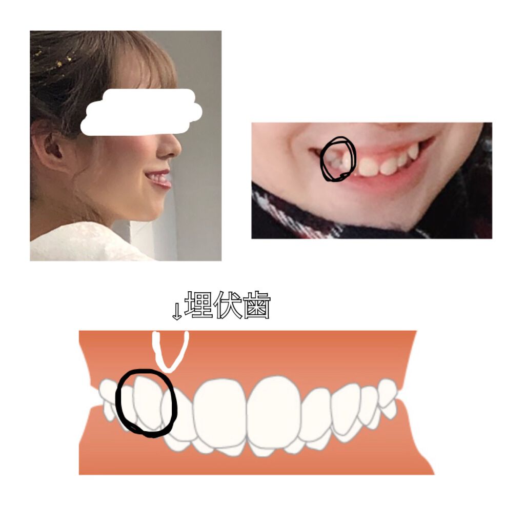 ããð ððž on LIPS ãæ¯åç¯æ£å§ããŸããïŒç¬¬1匟ïŒç§ã®æ¯äžŠã³ã§ããâ»2æç®åç
§ãèŠèŠ..ãïŒ2æç®ïŒ