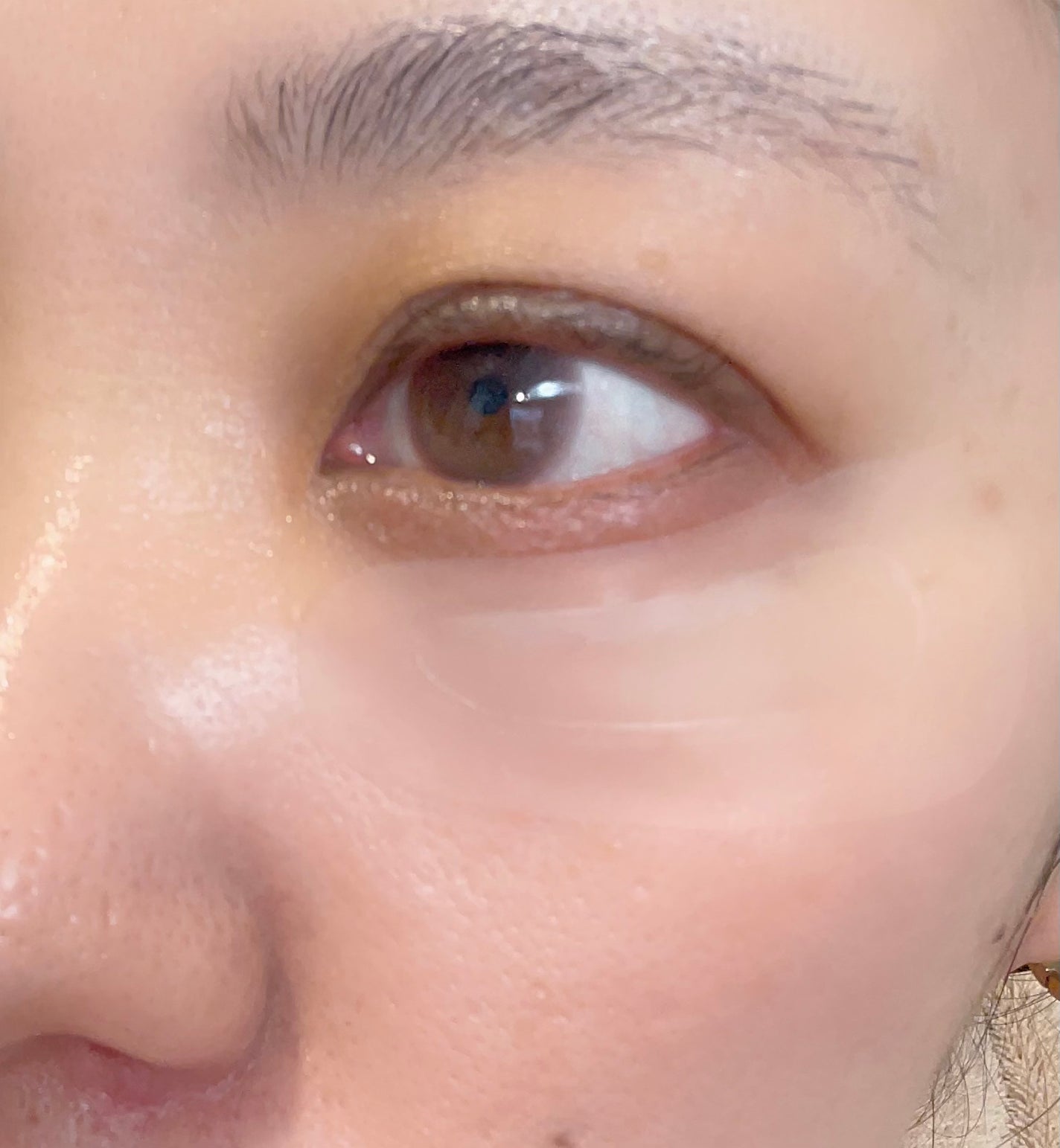 リンクルスポットマスク/クオシア/シートマスク・パックを使ったクチコミ(5枚目)