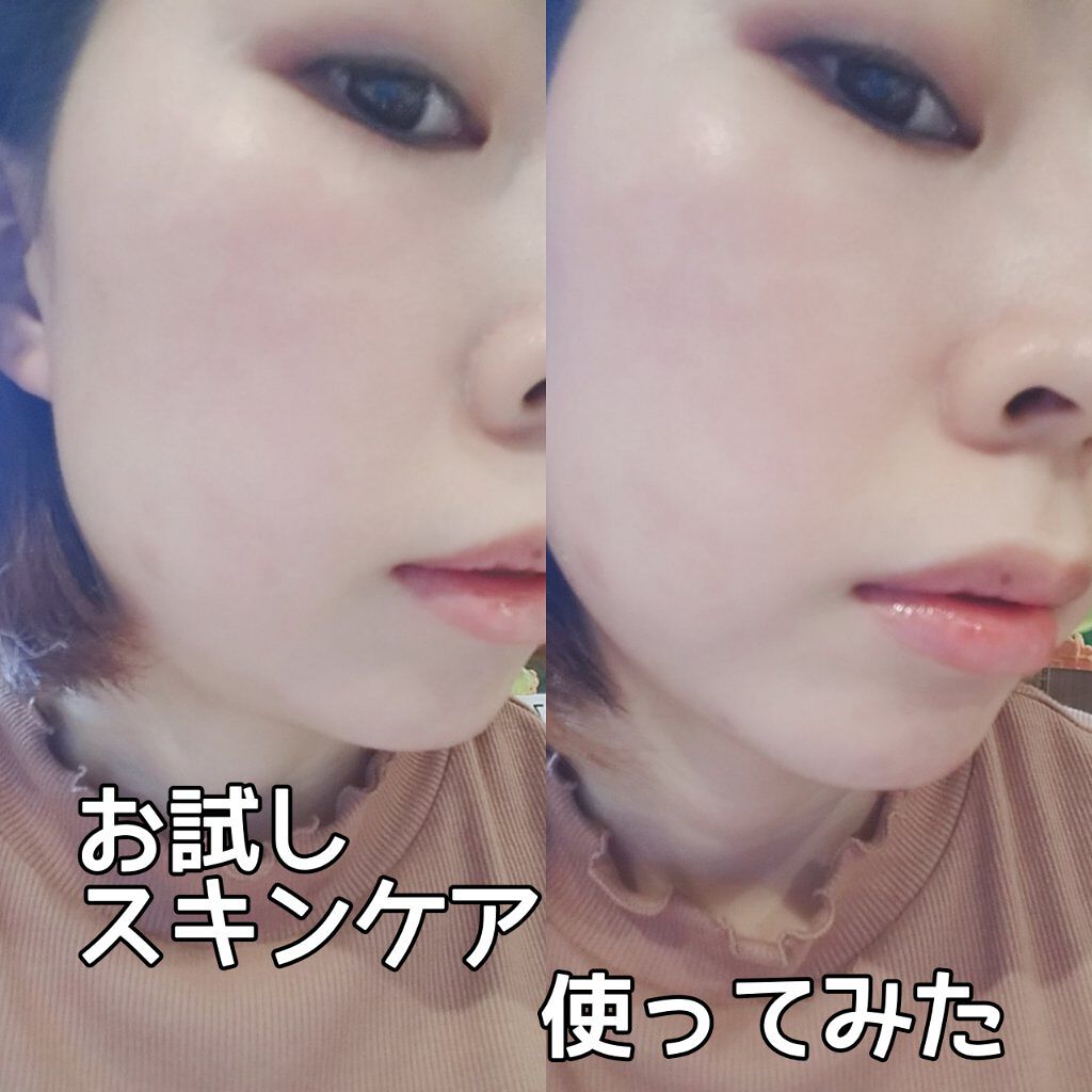 ディープモイスト ローション D/アベンヌ/化粧水を使ったクチコミ（1枚目）