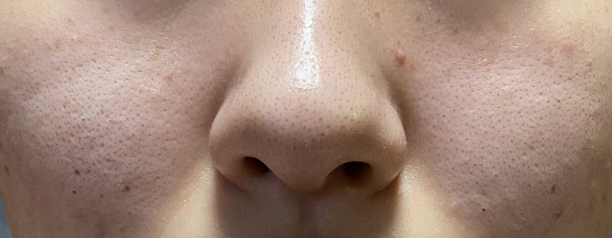 薬用しみ対策 美白化粧水/メラノCC/化粧水を使ったクチコミ（2枚目）