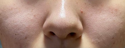 薬用しみ対策 美白化粧水/メラノCC/化粧水を使ったクチコミ(2枚目)