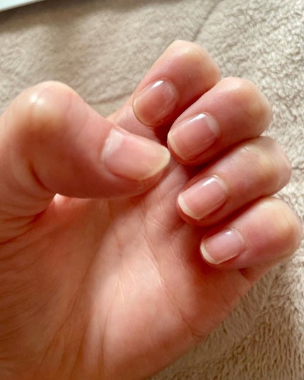グロスフォーユアネイル/プレビュート/オールインワンネイルを使ったクチコミ(3枚目)