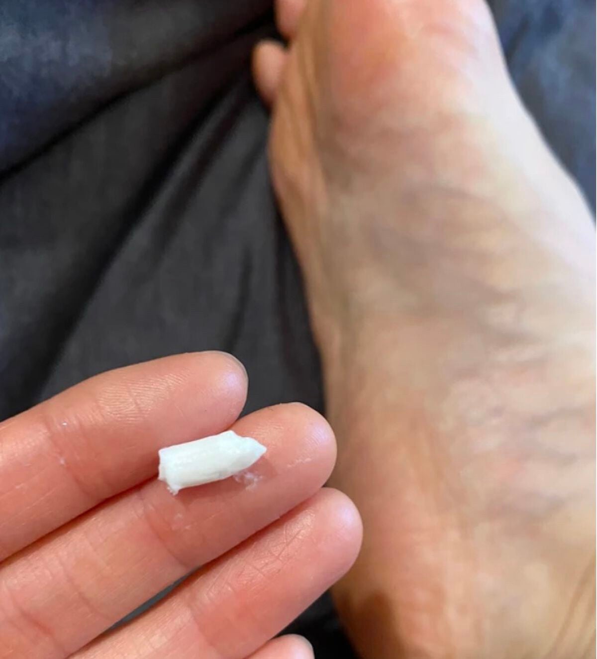 角質柔軟&保湿フットクリーム/ベビーフット/レッグ・フットケアを使ったクチコミ(2枚目)