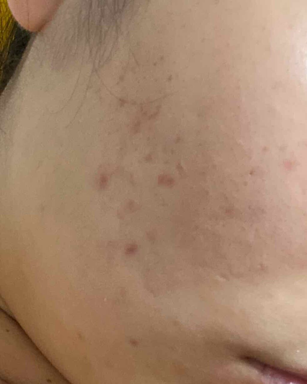 明色美顔水 薬用化粧水/美顔/化粧水を使ったクチコミ（3枚目）