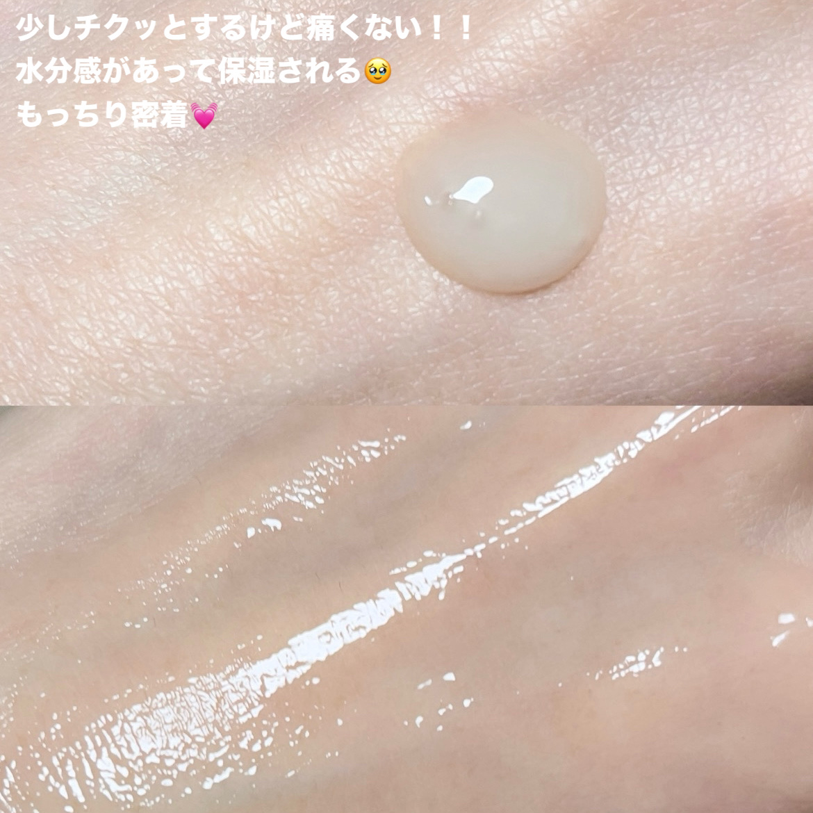 PDRNショット675/COSNORI/美容液を使ったクチコミ（3枚目）