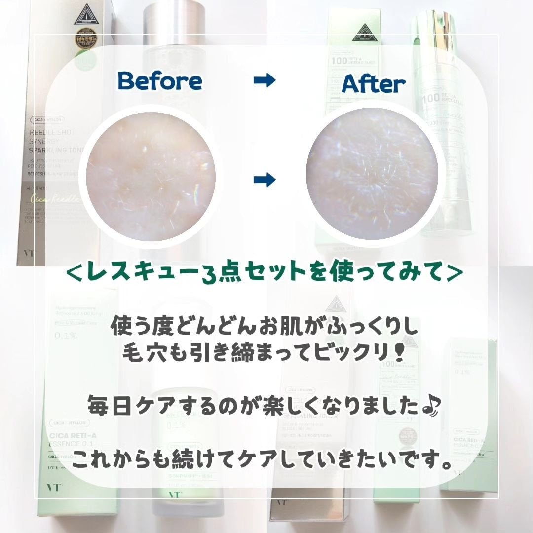 シカレチA エッセンス0.1/VT/美容液を使ったクチコミ(5枚目)
