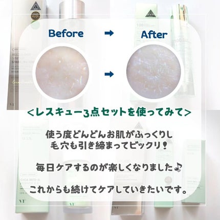 シカレチA エッセンス0.1/VT/美容液を使ったクチコミ(5枚目)