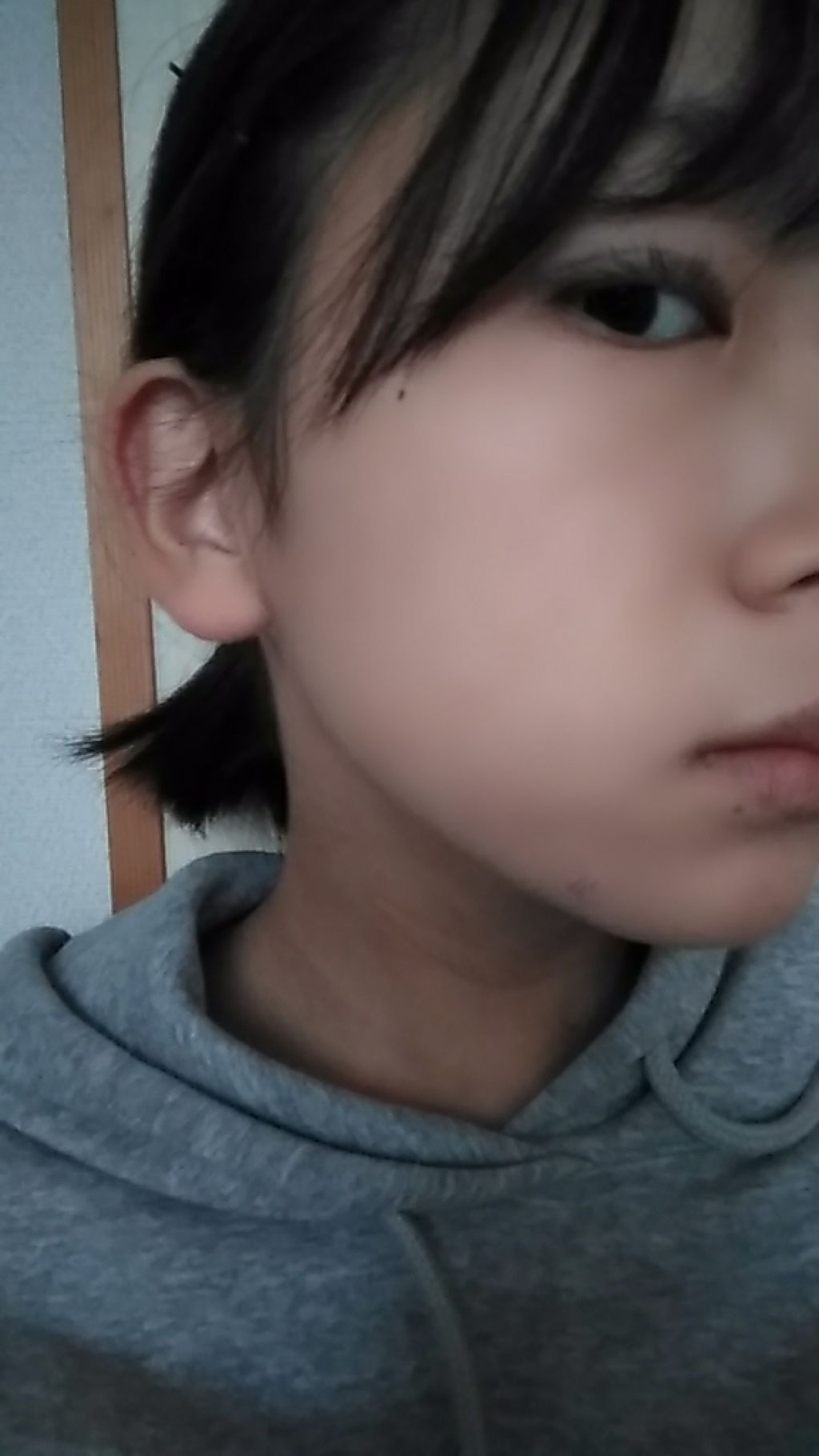 HPクリーム(医薬品)/ノバルティス ファーマ/その他を使ったクチコミ(3枚目)