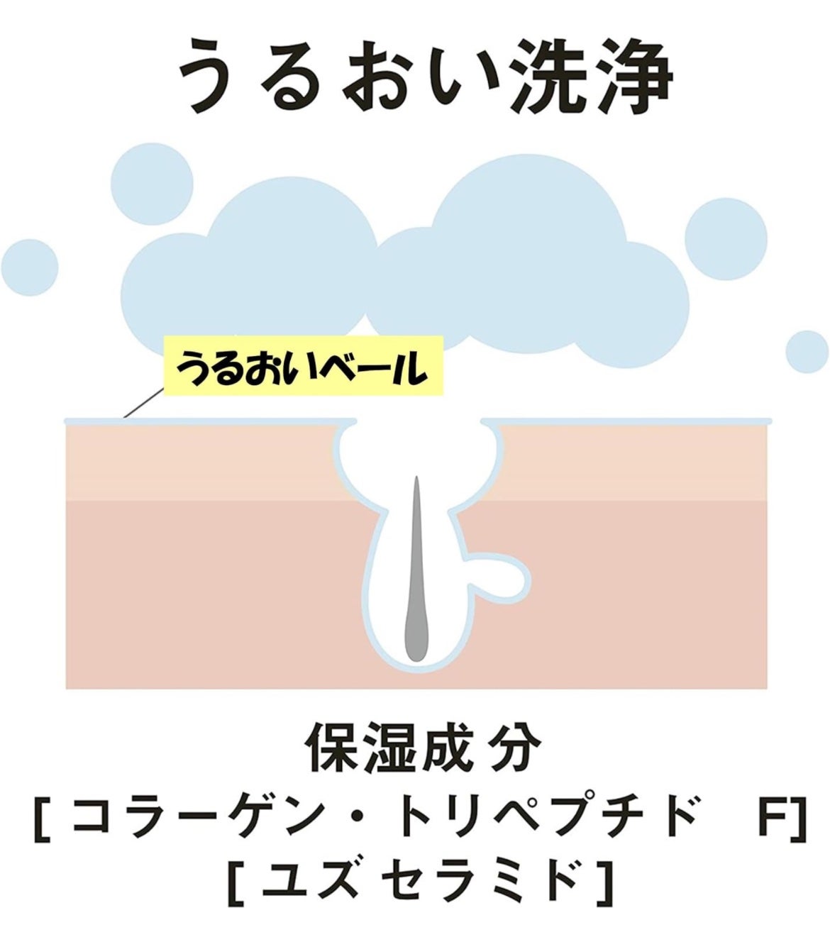 ニキビを防ぐ薬用石鹸 ForBack/ペリカン石鹸/ボディ石鹸を使ったクチコミ(5枚目)