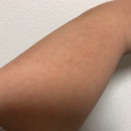 バスタイム除毛クリーム 敏感肌用/Veet/除毛クリームを使ったクチコミ(3枚目)