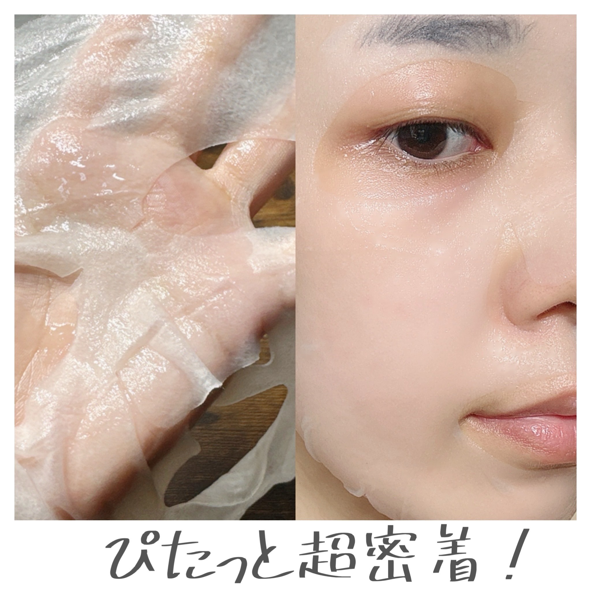 グルタチオンナイアシンアミドアンプルセラム/APLB/美容液を使ったクチコミ（2枚目）