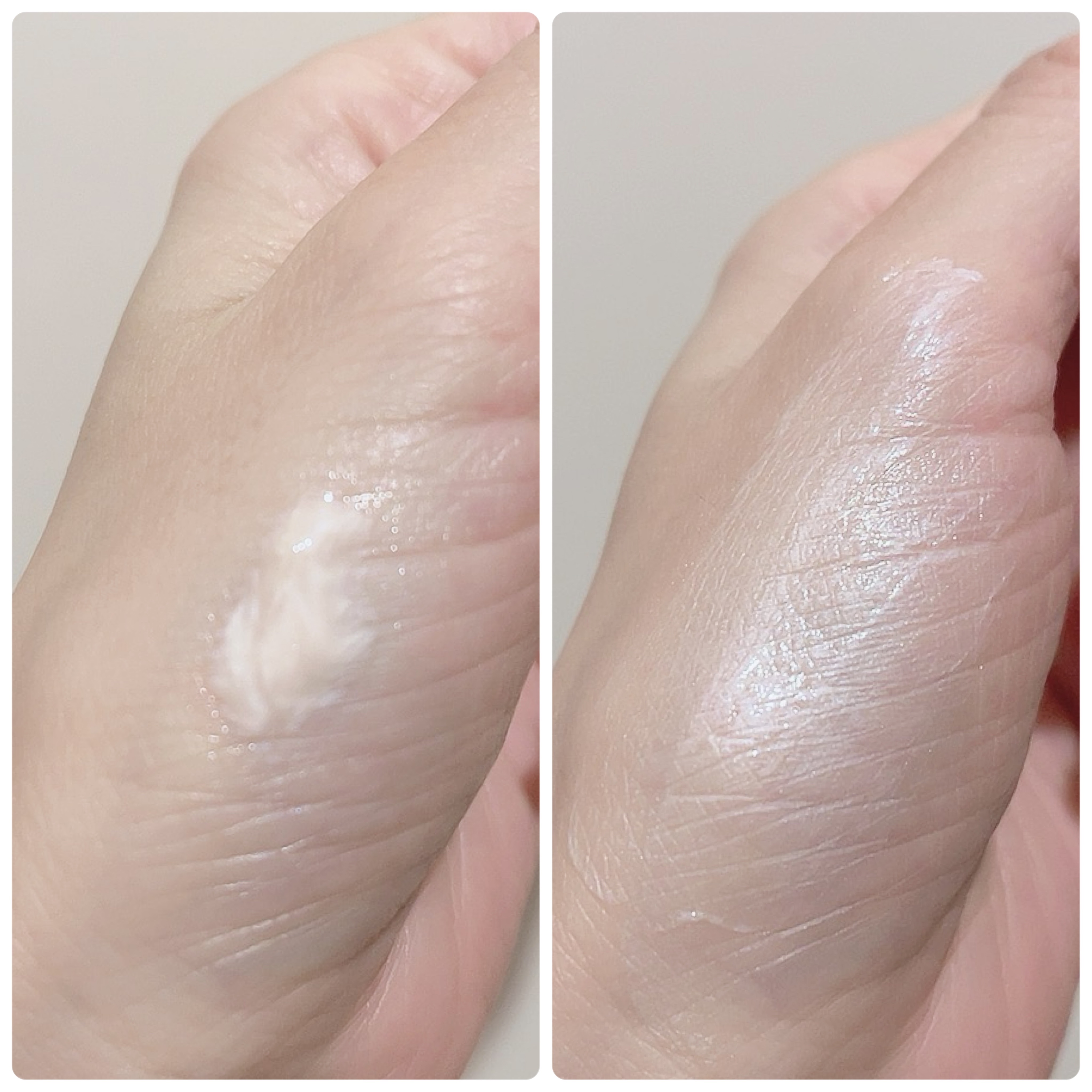 薬用 リンクル美コルセットゲル/プリオール/オールインワン化粧品を使ったクチコミ（3枚目）