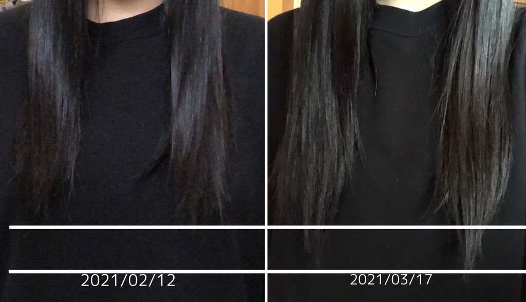 DHC 亜鉛/DHC/健康サプリメントを使ったクチコミ（3枚目）