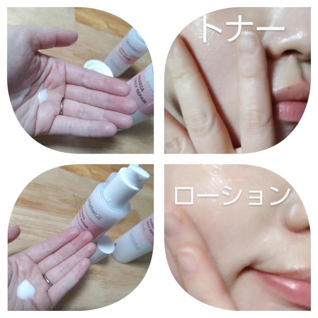 マデカデイリーリペアトナー/センテリアン24/化粧水を使ったクチコミ（2枚目）