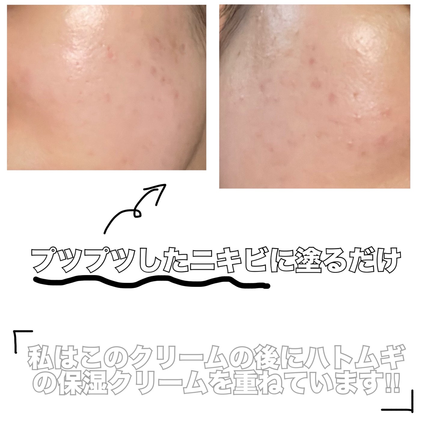 マデカソ CICAクリーム /A’pieu/フェイスクリームを使ったクチコミ(2枚目)