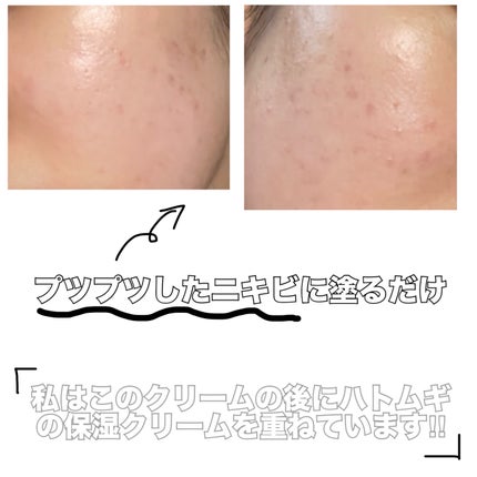 マデカソ CICAクリーム   50ml/A’pieu/フェイスクリームの画像