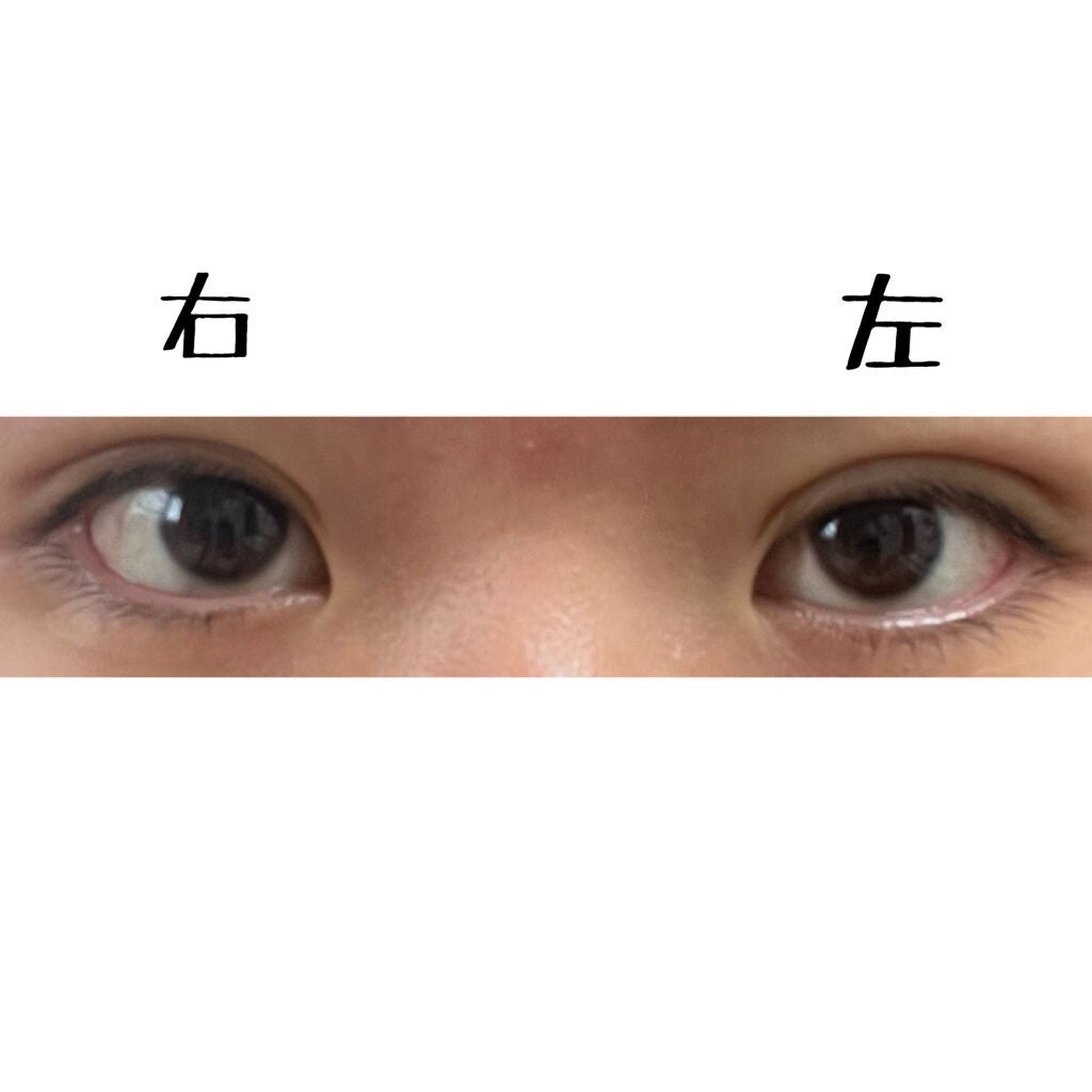 ïŸïŸð on LIPS ãããã«ã¡ã¯ãããã§ãð3æ¥ç®ã§ãïŒïŒä»æ¥ã®ç¶æ
ã¬ãããŠãããŸã..ãïŒ3æç®ïŒ