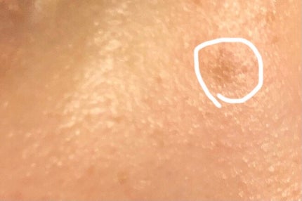 ビューティー カバーペンシル スリム-1/三善/ペンシルコンシーラーを使ったクチコミ(2枚目)