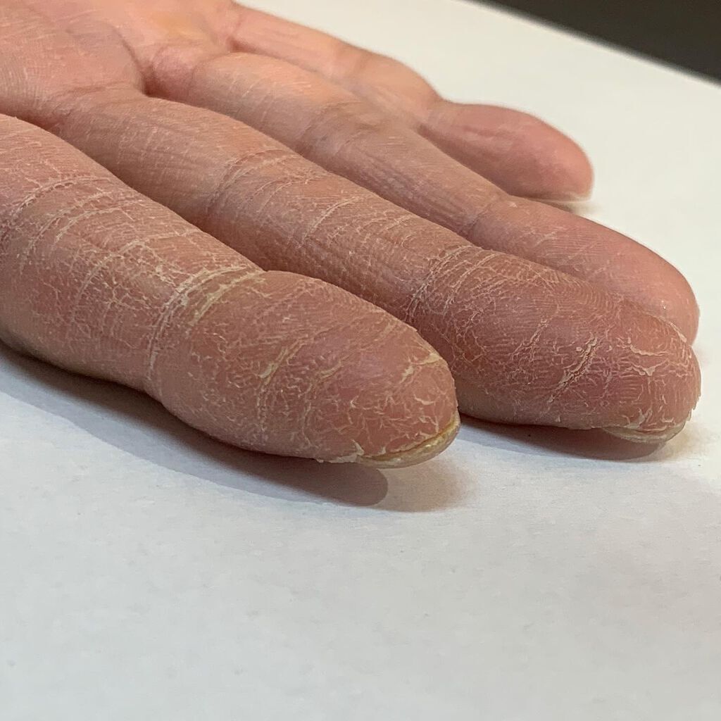 ベビーワセリン/健栄製薬/ボディクリームを使ったクチコミ(9枚目)