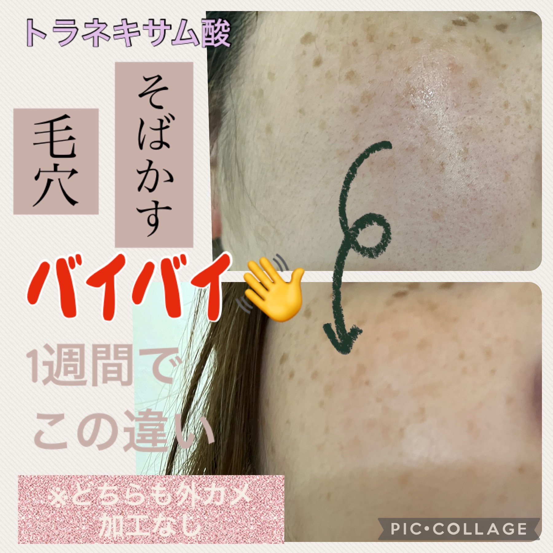 TXトーニングエッセンス1000SHOT/VT/美容液を使ったクチコミ（2枚目）