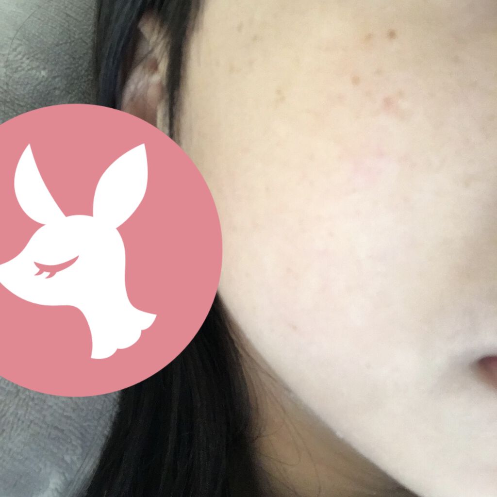 薬用 しみ 集中対策 美容液/メラノCC/美容液を使ったクチコミ（1枚目）