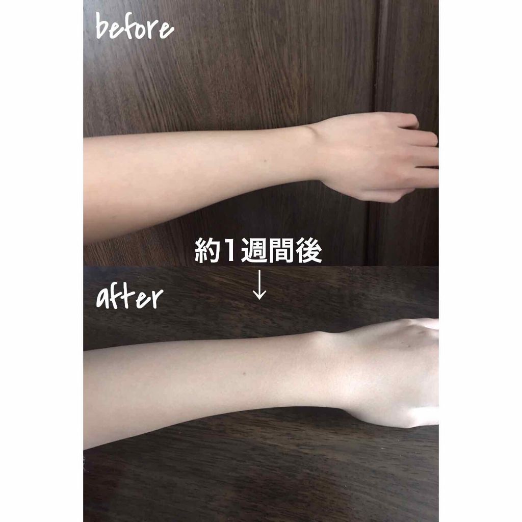 ハトムギ化粧水(ナチュリエ スキンコンディショナー R )/ナチュリエ/化粧水を使ったクチコミ（1枚目）