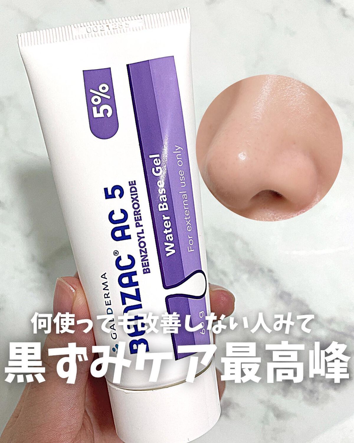 ベンザック ACジェル(医薬品)/ガルデルマ/その他を使ったクチコミ（1枚目）