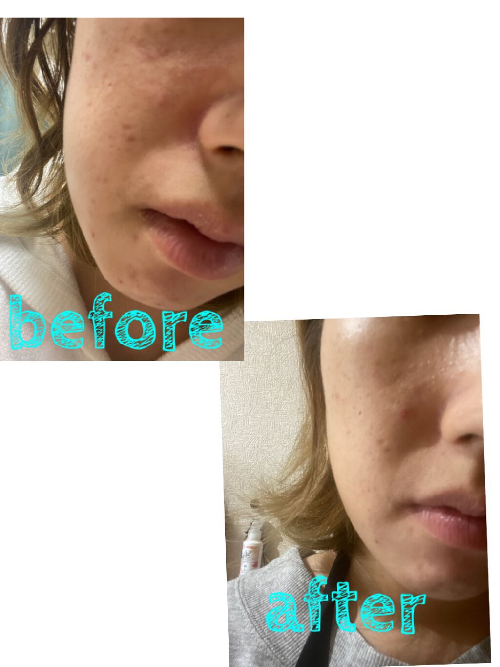 ジェニフィック アドバンスト N/LANCOME/美容液を使ったクチコミ(2枚目)