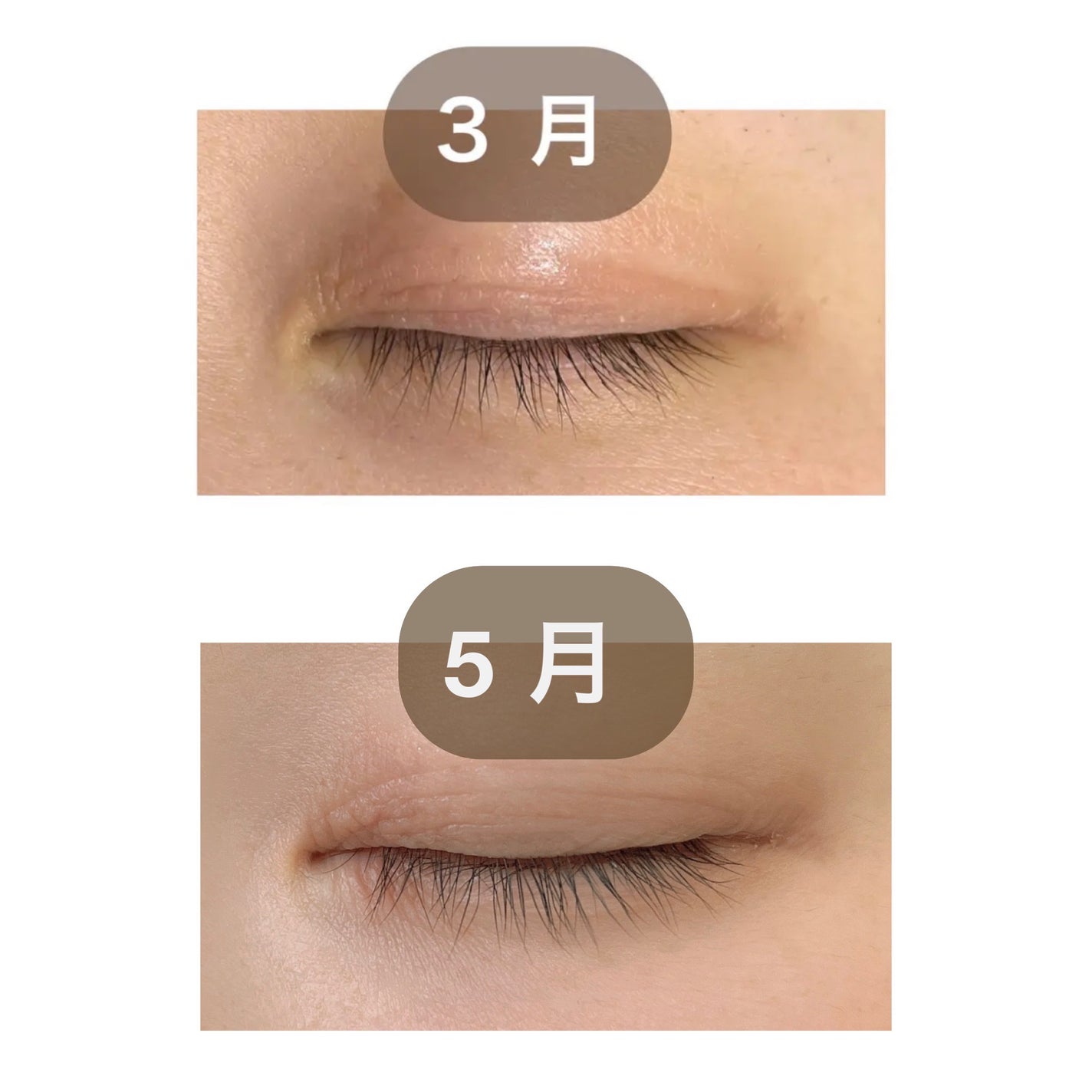 アイラッシュセラム プレミアムEX/ヒロインメイク/まつげ美容液を使ったクチコミ(2枚目)