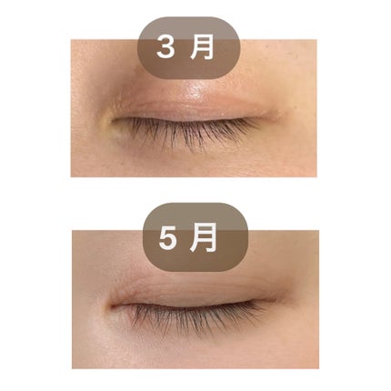 アイラッシュセラム プレミアムEX/ヒロインメイク/まつげ美容液を使ったクチコミ(2枚目)