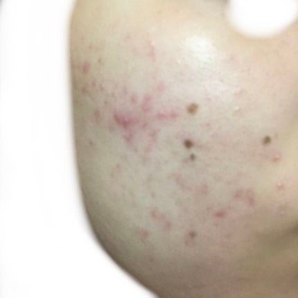 化粧水・敏感肌用・高保湿タイプ/無印良品/化粧水を使ったクチコミ(3枚目)