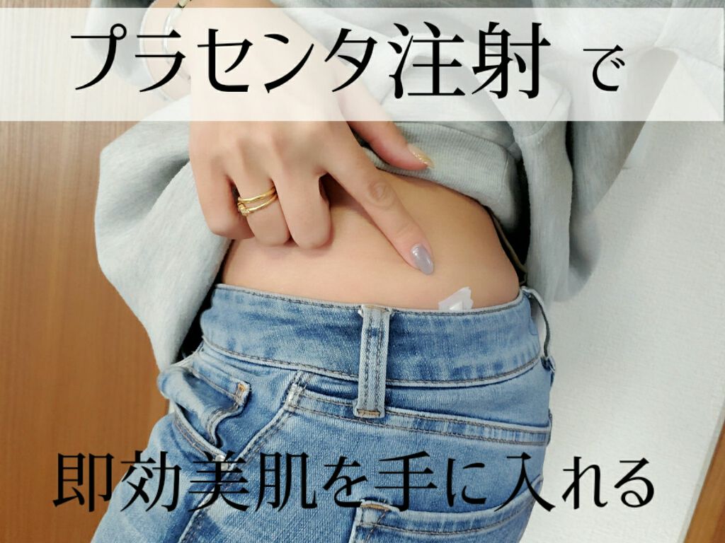 ããŒð on LIPS ããã©ã»ã³ã¿æ³šå°ã£ãŠãåãã§ããïŒïŒç§ã¯çŸå®¹ã®çºã«ç®èç§ã§å®æç..ãïŒ1æç®ïŒ