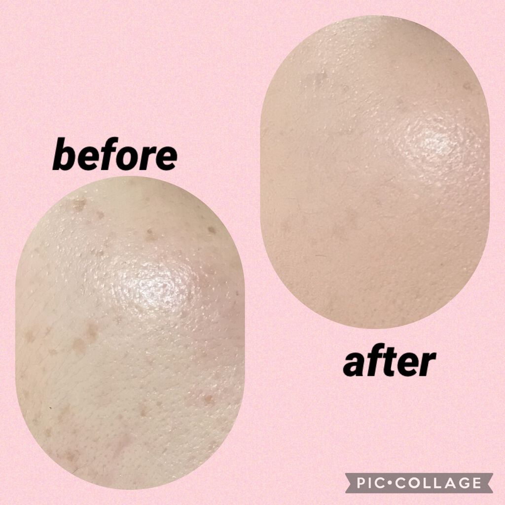 フィットミー コンシーラー/MAYBELLINE NEW YORK/リキッドコンシーラーを使ったクチコミ(3枚目)