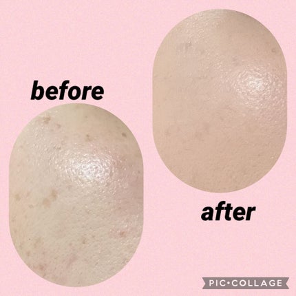 フィットミー コンシーラー 15/MAYBELLINE NEW YORK/リキッドコンシーラーを使ったクチコミ(3枚目)