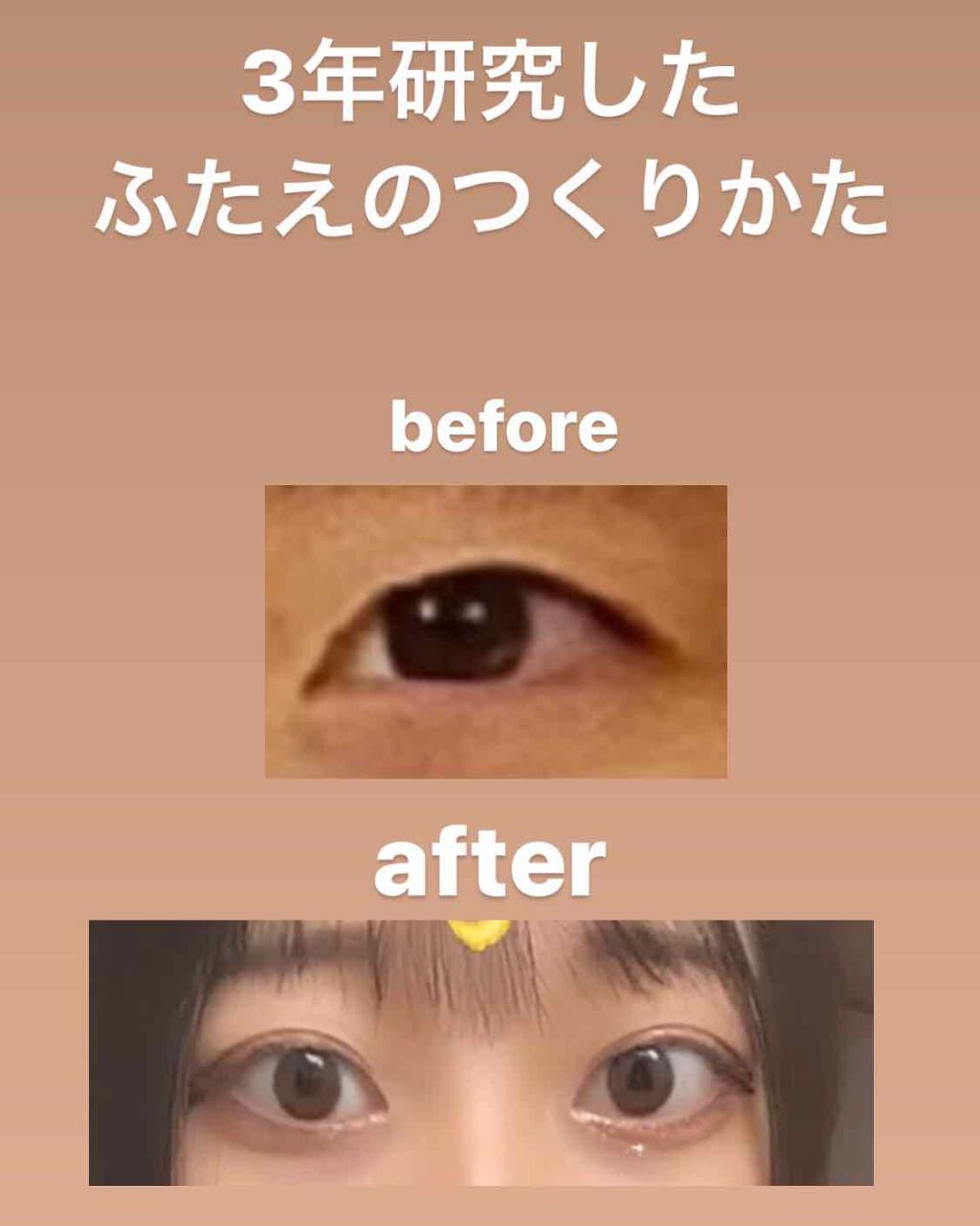 アイトーク スーパーウォータープルーフ/アイトーク/二重まぶた用アイテムを使ったクチコミ（1枚目）