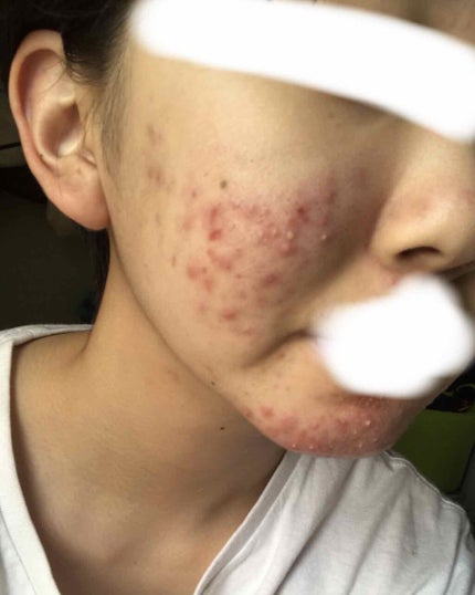 を使ったクチコミ(2枚目)