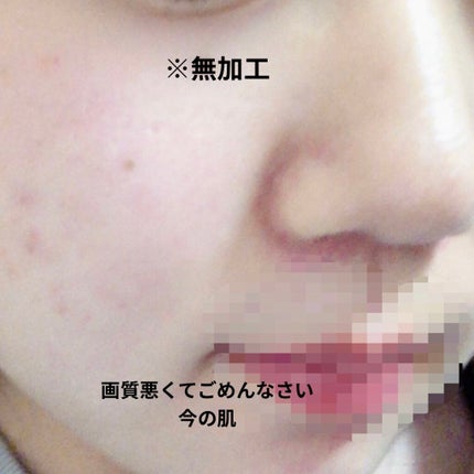 CICA デイリースージングマスク/VT/シートマスク・パックを使ったクチコミ(5枚目)