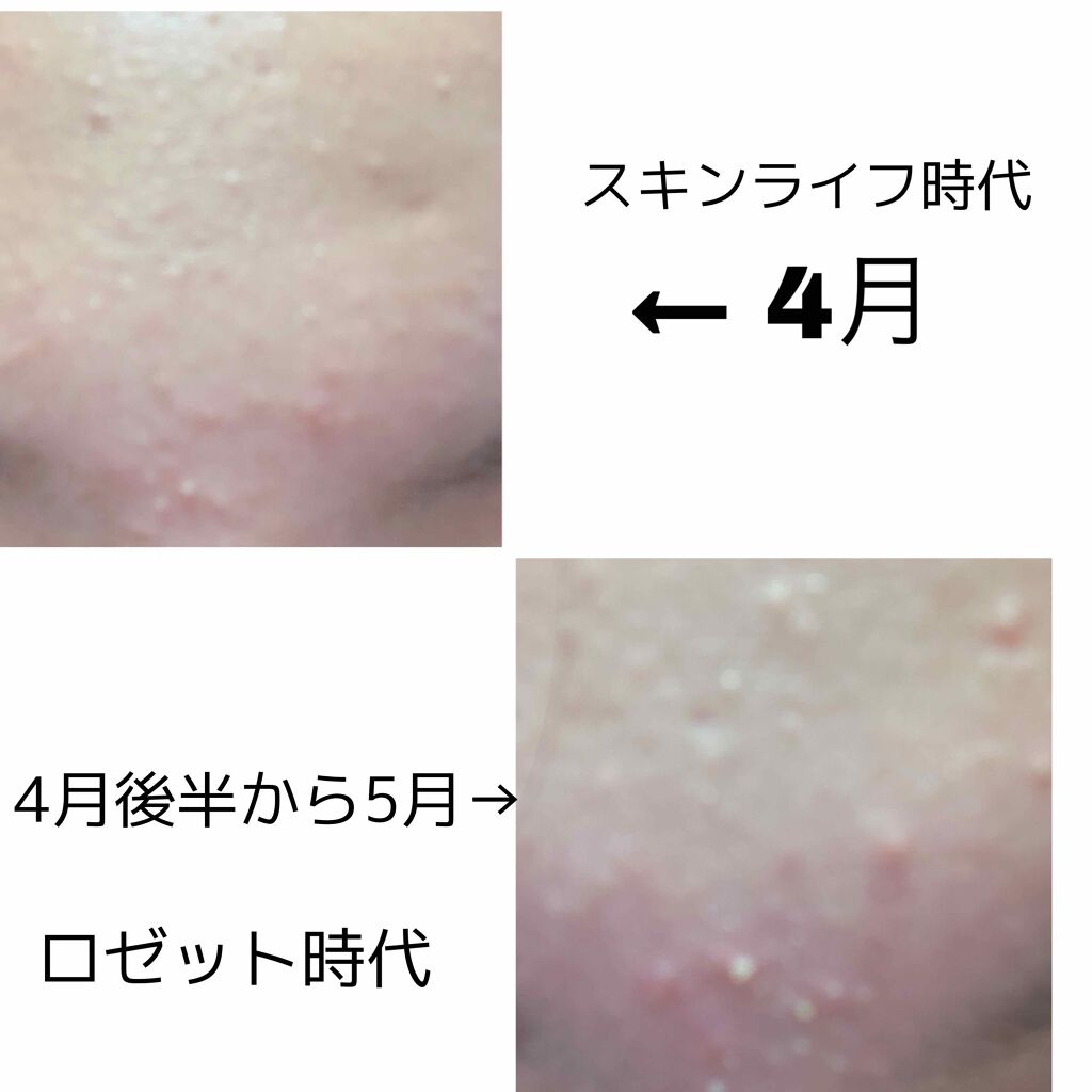 ロゼット 洗顔パスタ 荒性肌/ロゼット/洗顔フォームを使ったクチコミ(2枚目)