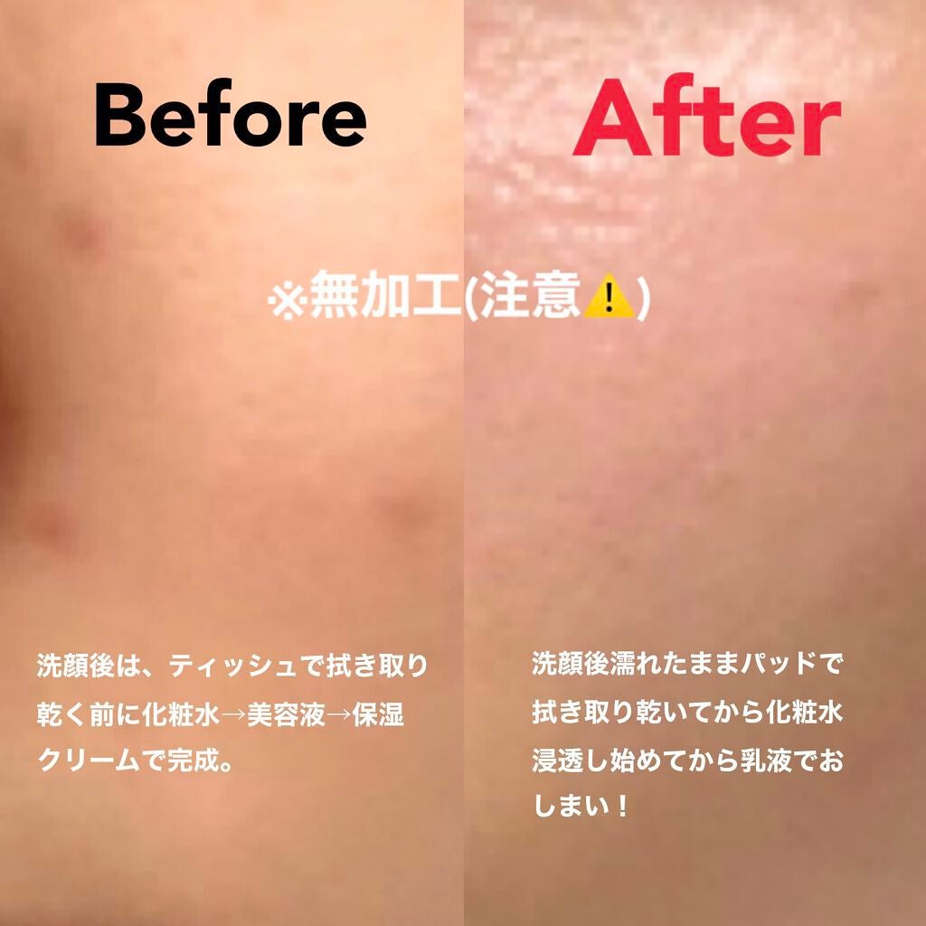 ヘルプミー! ポア-Tパッド/One-day's you/トナーパッドを使ったクチコミ(2枚目)