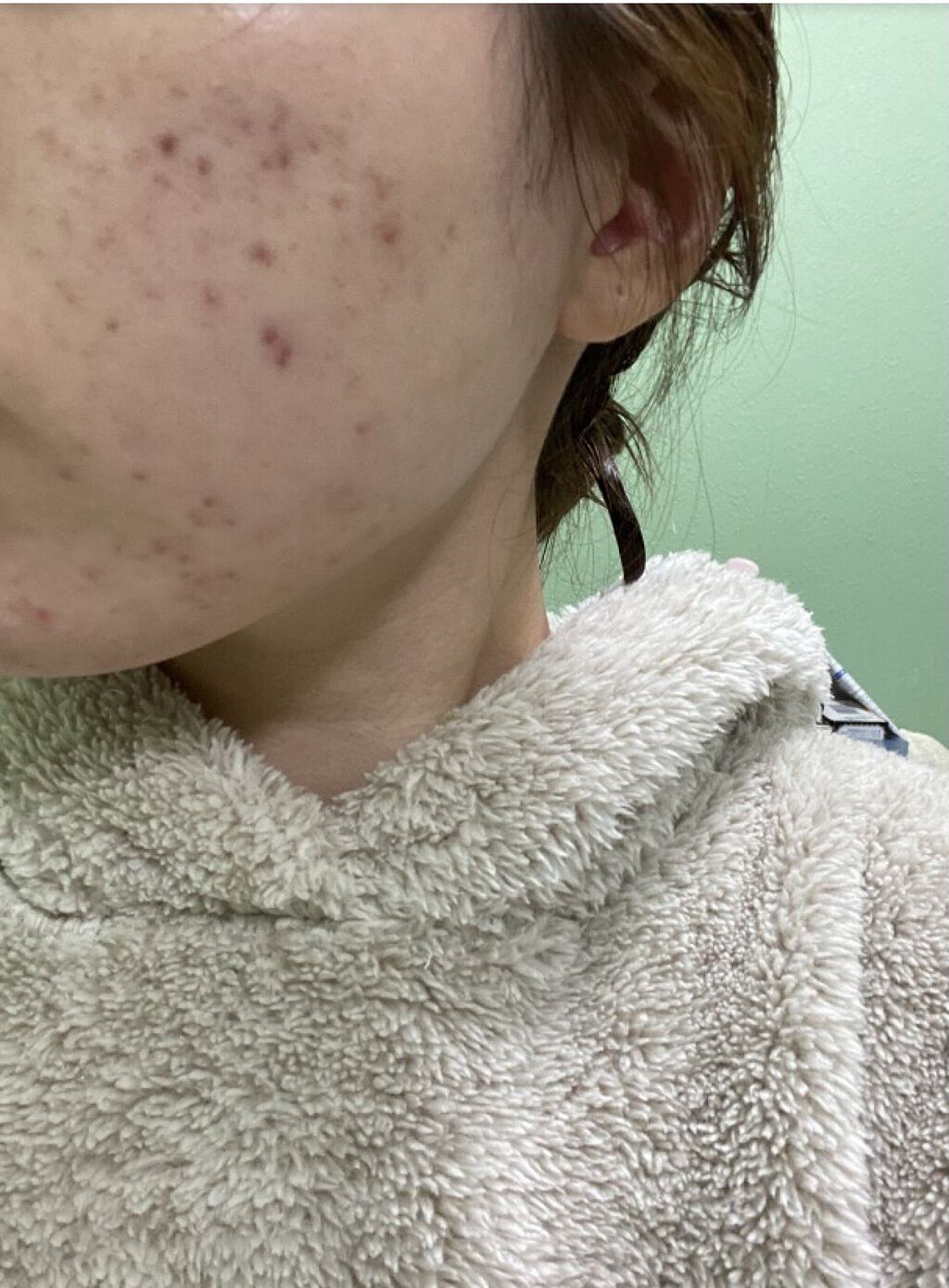 トラブルリペア リキッド/アルージェ/美容液を使ったクチコミ（3枚目）