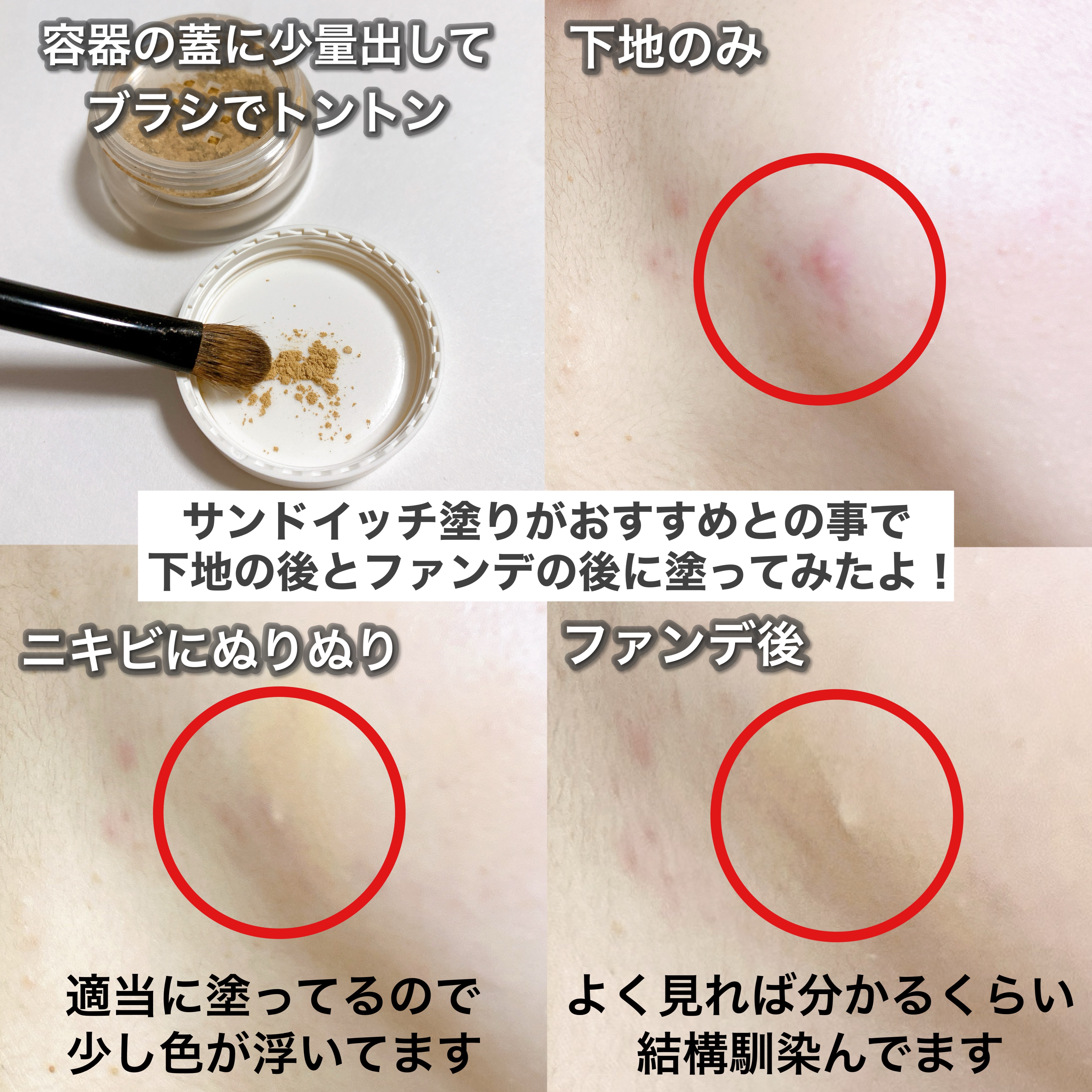 薬用コンシーラー アクネプロテクター/ONLY MINERALS/パウダーコンシーラーを使ったクチコミ（3枚目）