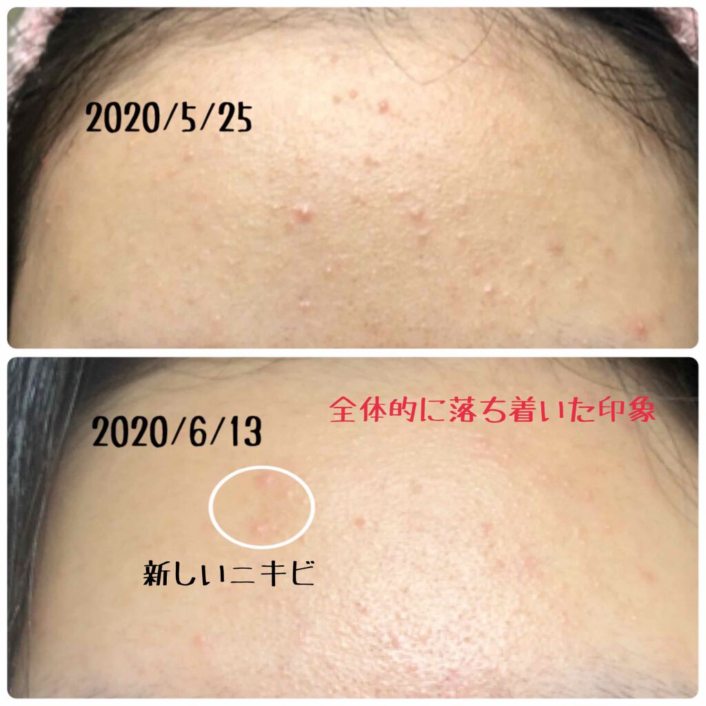 ファイバーフォーム/ルナメアAC/洗顔フォームを使ったクチコミ（3枚目）