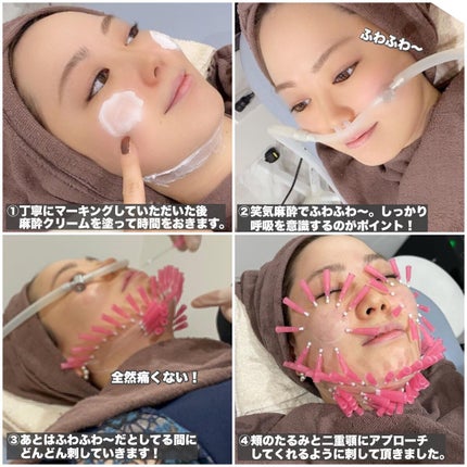 Riho | 集英社MAQUIAエキスパート on LIPS 「ショッピングリフト受けてみた‼️最近本当に二重顎、頬のたるみに..」(5枚目)