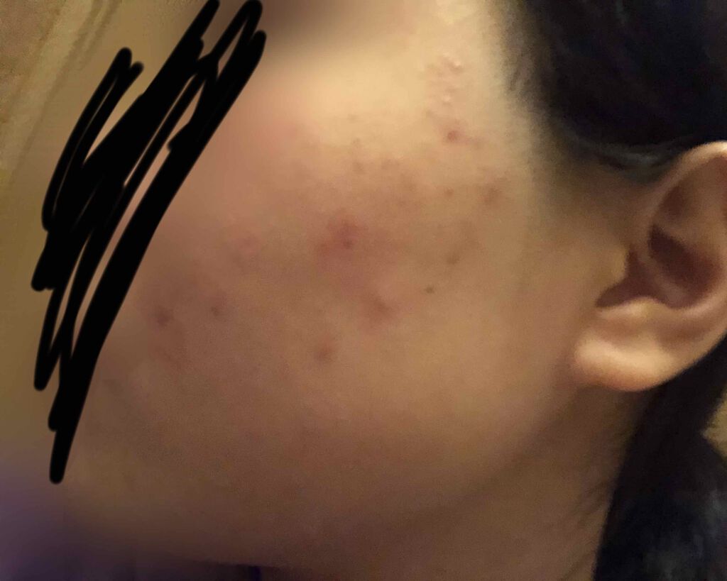 ハトムギ化粧水(ナチュリエ スキンコンディショナー R )/ナチュリエ/化粧水を使ったクチコミ（2枚目）