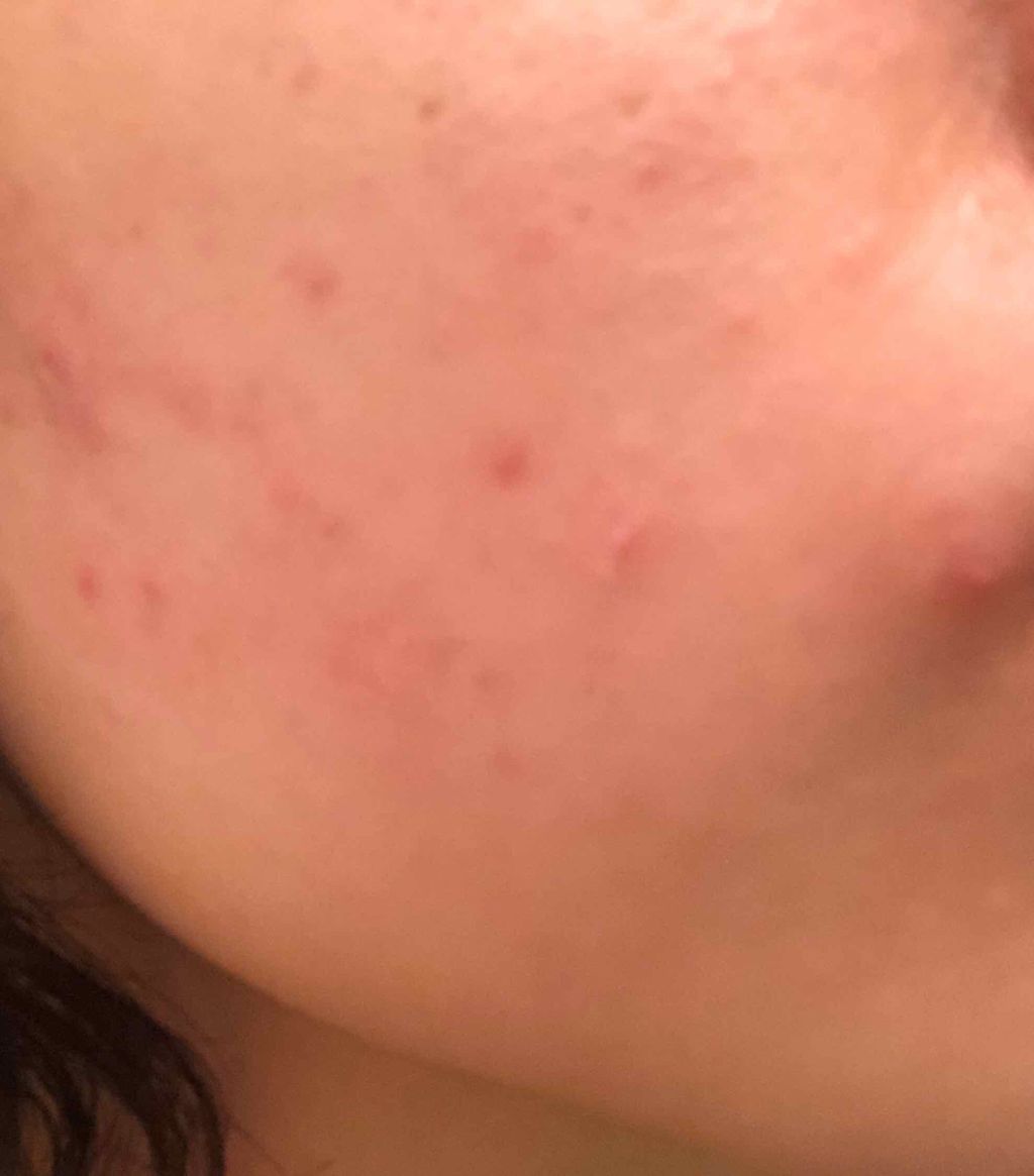 ビジャ シカバーム EX/innisfree/フェイスバームを使ったクチコミ（3枚目）