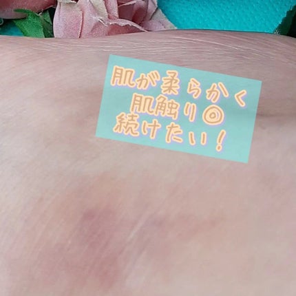 タカミスキンピールボディ/タカミ/ボディローションを使ったクチコミ(6枚目)