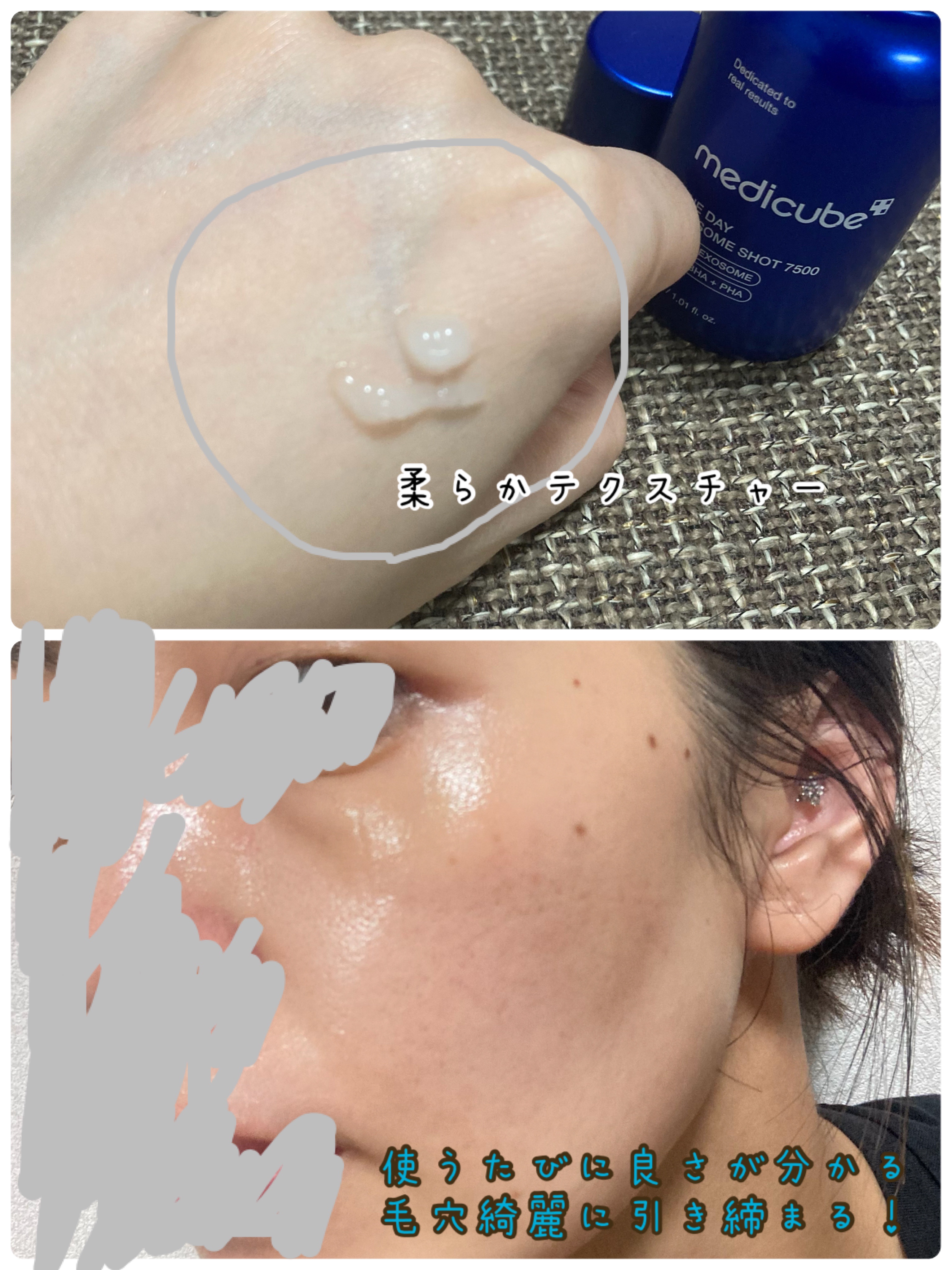 ゼロ毛穴パッド 2.0/MEDICUBE/トナーパッドを使ったクチコミ（3枚目）