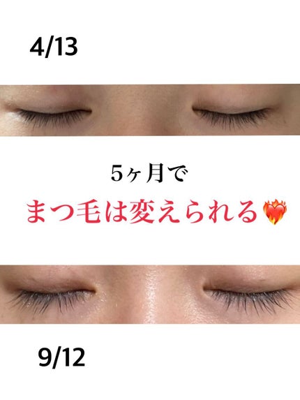 EMAKED(エマーキット)/水橋保寿堂製薬/まつげ美容液を使ったクチコミ(1枚目)